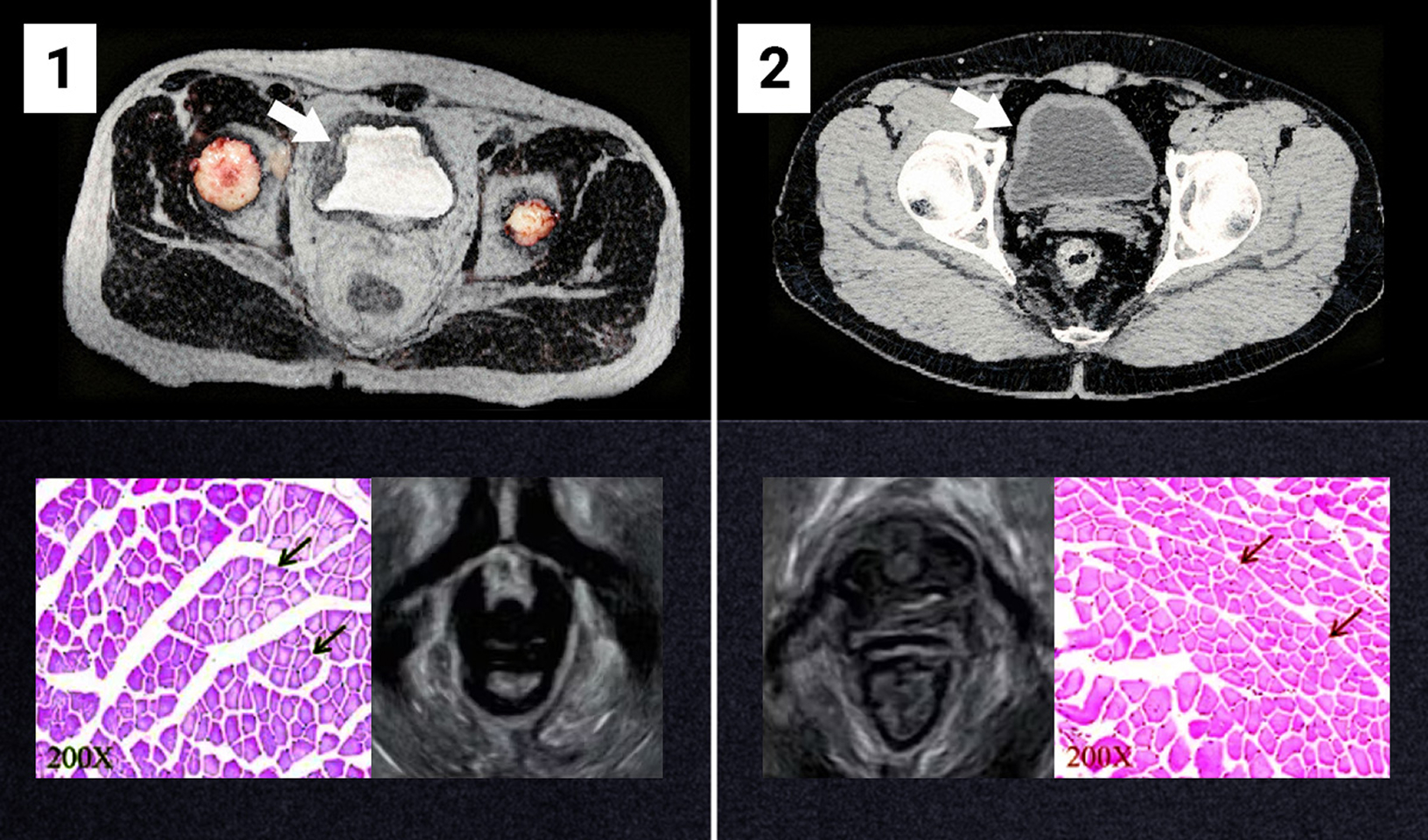 Medicinski posnetki sečnega mehurja
